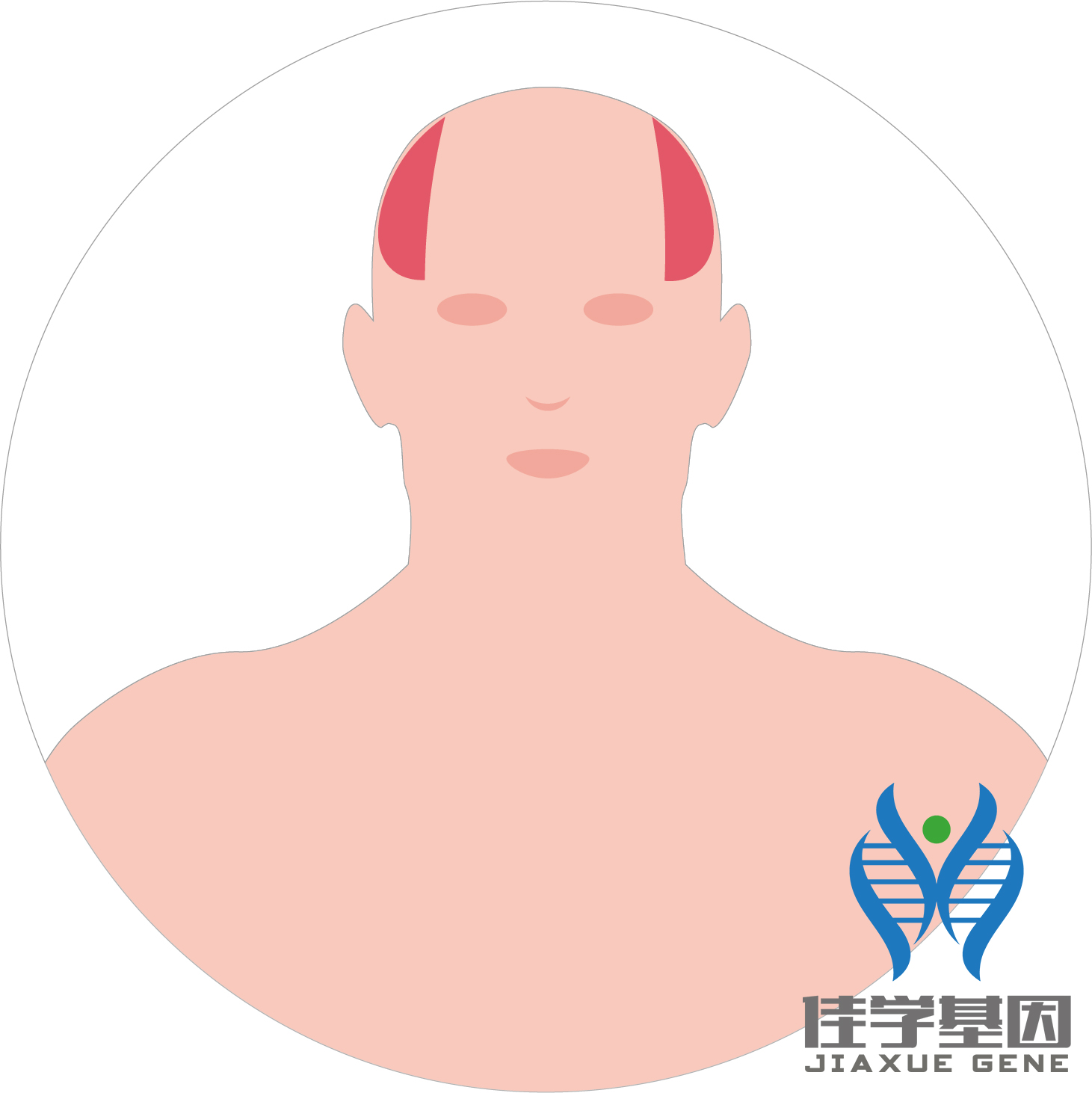 【佳學(xué)基因檢測(cè)】男性<font color='red'>脫發(fā)</font>（Androgenetic alopecia）基因解碼、<a href=http://www.lucasfraser.com/tk/jiema/cexujishu/2021/31933.html>基因檢測(cè)</a>