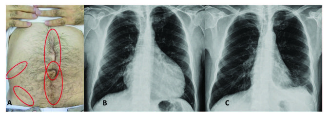 包含圖片、插圖等的外部文件。對象名稱為 turkjmedsci-50-1591-fig001.jpg