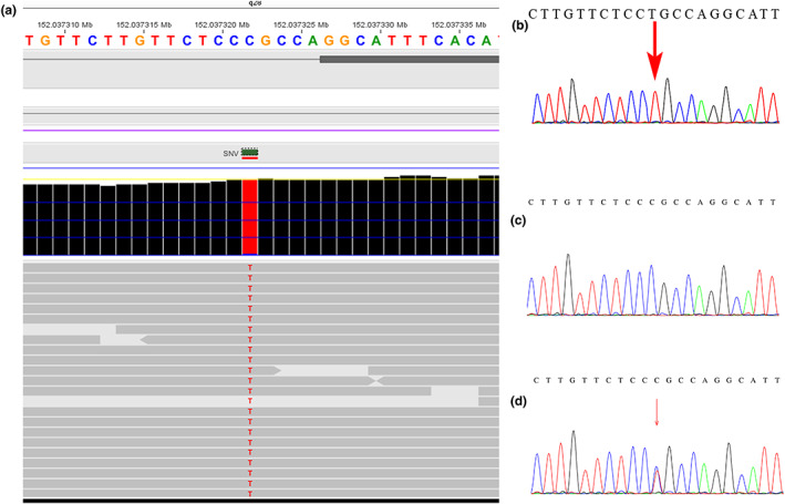 An external file that holds a picture, illustration, etc.
Object name is MGG3-11-e2121-g002.jpg